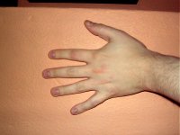 My hand. 