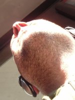 A swirl of stubble. 
