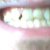 My teeth are in terrible condition. Soon I am getting my wisdom teeth out. I will no longer be wise.
